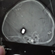 Image for article titled This is what happens when you try to scan a brain with a bullet in it